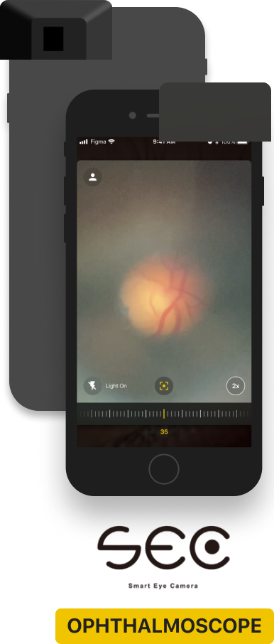 SEC-ophthalmoscope-model