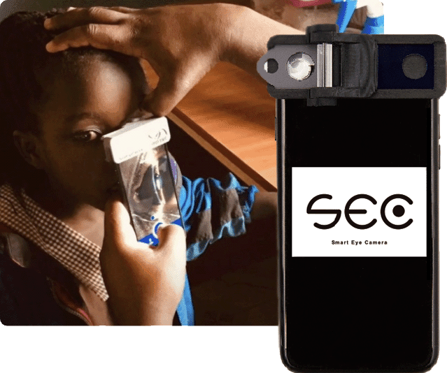 眼科医の“眼”を世界に広げる